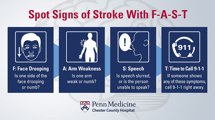 Spot the signs of a Stroke.